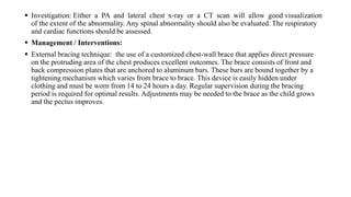 CHEST WALL DEFORMITY