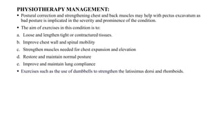 CHEST WALL DEFORMITY