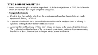 CHEST WALL DEFORMITY