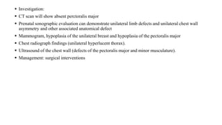 CHEST WALL DEFORMITY