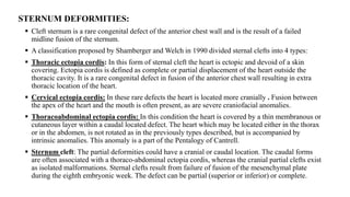 CHEST WALL DEFORMITY