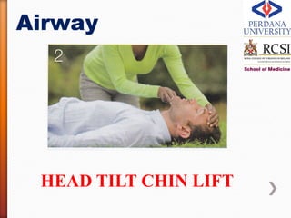 Airway




 HEAD TILT CHIN LIFT
 