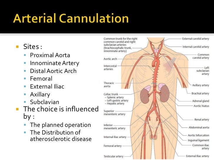 Cardiopulmonary bypass
