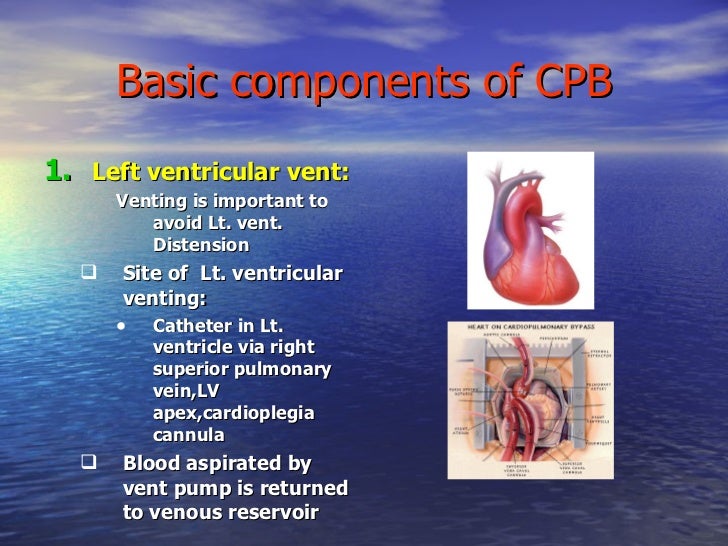 Cardiopulmonary bypass