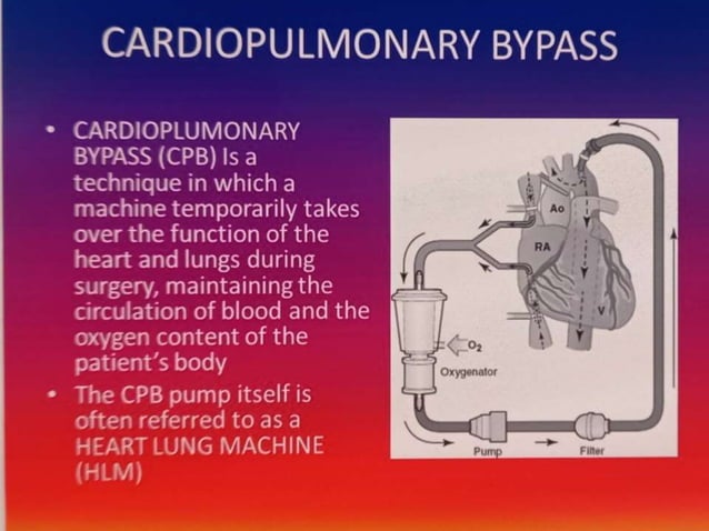 Cardio Pulmonary Bypass pptx Cardio Pulmonary Bypass pptx