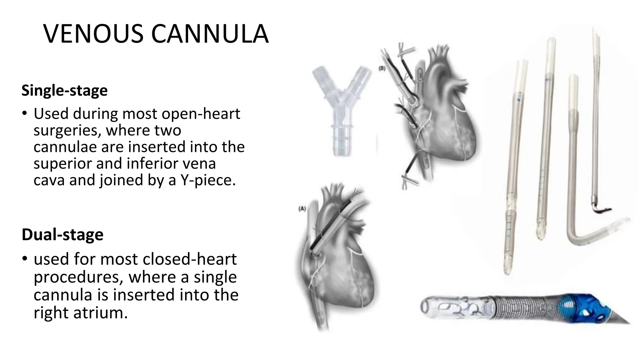 VENOUS CANNULA
Single-stage
• Used during most open-heart
surgeries, where two
cannulae are inserted into the
superior and inferior vena
cava and joined by a Y-piece.
Dual-stage
• used for most closed-heart
procedures, where a single
cannula is inserted into the
right atrium.
 