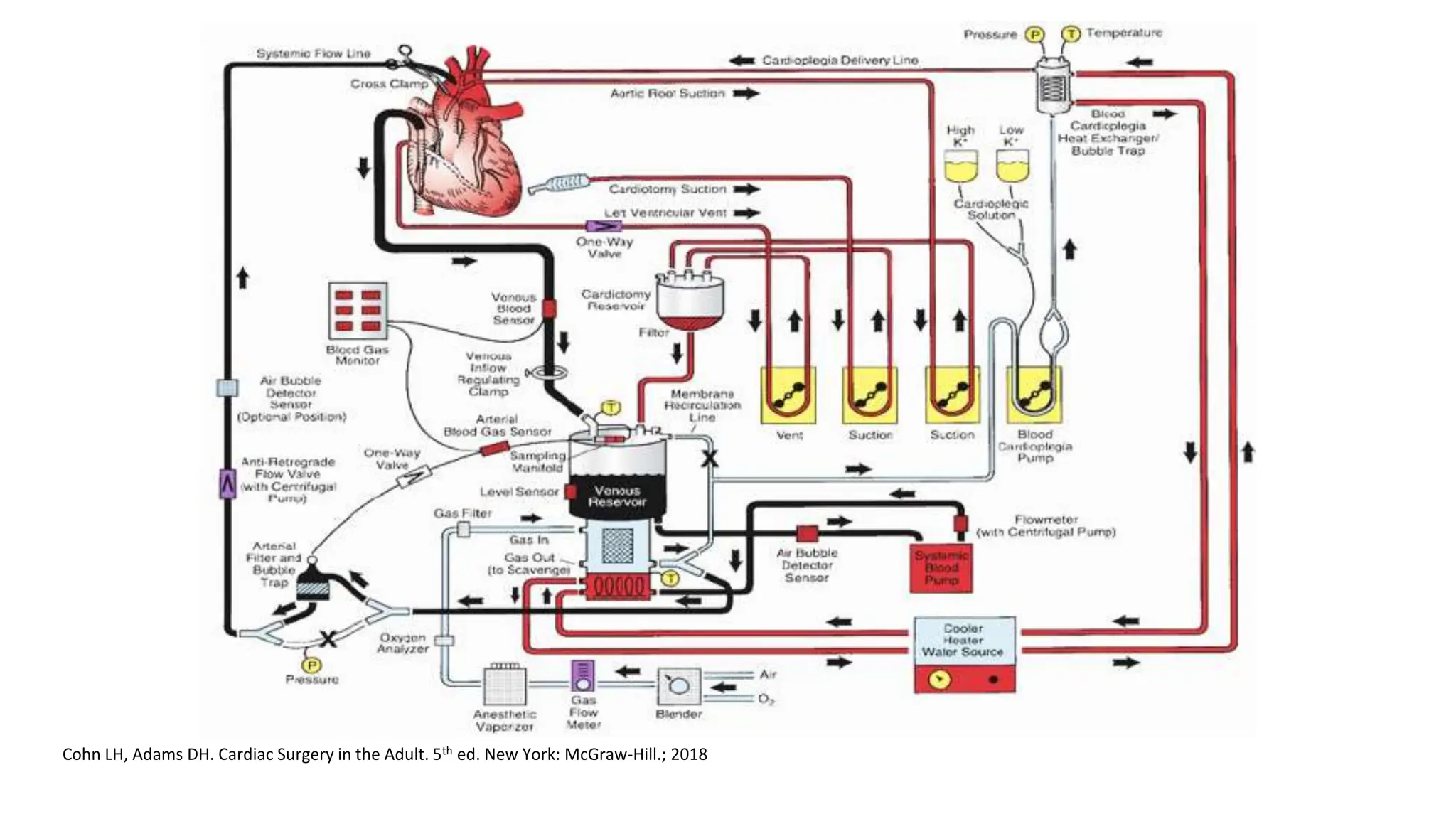 Cohn LH, Adams DH. Cardiac Surgery in the Adult. 5th ed. New York: McGraw-Hill.; 2018
 