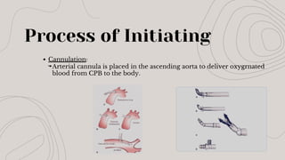 Process of Initiating
Cannulation:
Arterial cannula is placed in the ascending aorta to deliver oxygrnated
blood from CPB to the body.
 