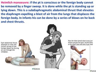 Samir Rafla-CARDIOPULMONARY Resuscitation | PPTX