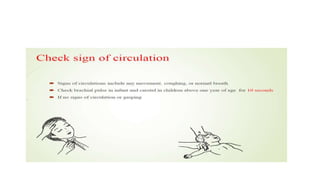 Cardiopulmonary resucitation