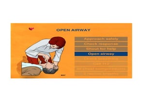 Cardiopulmonary resucitation