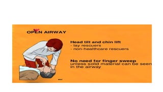 Cardiopulmonary resucitation