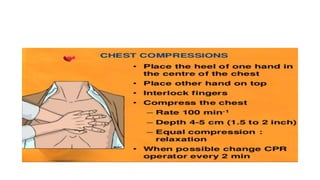 Cardiopulmonary resucitation