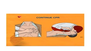 Cardiopulmonary resucitation