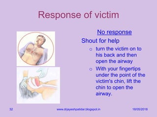 18/05/2018www.drjayeshpatidar.blogspot.in32
Response of victim
No response
Shout for help
o turn the victim on to
his back and then
open the airway
o With your fingertips
under the point of the
victim's chin, lift the
chin to open the
airway.
 