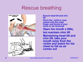 18/05/2018www.drjayeshpatidar.blogspot.in35
Rescue breathing
Ensure head tilt and chin
lift
Pinch the victim’s nose
closed with the index
finger and thumb of your
hand on his forehead
Open his mouth a little,
but maintain chin lift
Maintaining head tilt and
chin lift, take your
mouth away from the
victim and watch for his
chest to fall as air
comes out
 