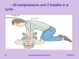 - 30 compressions and 2 breaths in a
cycle.
18/05/2018www.drjayeshpatidar.blogspot.in44
 