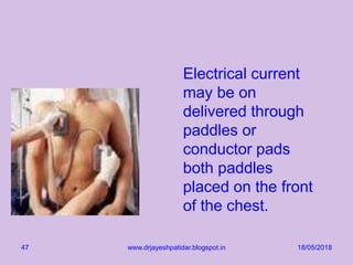 Electrical current
may be on
delivered through
paddles or
conductor pads
both paddles
placed on the front
of the chest.
18/05/2018www.drjayeshpatidar.blogspot.in47
 