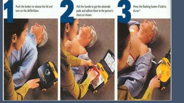 Cardio pulmonary resuscitation | PPT