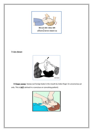 [CPCR] CARDIOPULMONARY CEREBREAL RESUSCITATION PROCEDURES | DOCX