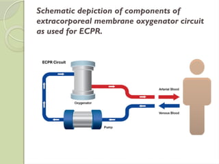 Module Ecpr CARDIOPULMONARY RESUSCITATION-AHA 2021.pptx