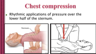 Rhythmic applications of pressure over the
lower half of the sternum.
 