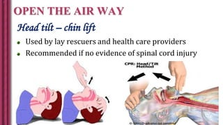 OPEN THE AIR WAY
Head tilt – chin lift
Used by lay rescuers and health care providers
Recommended if no evidence of spinal cord injury
 