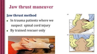 Jaw thrust maneuver
Jaw thrust method
In trauma patients where we
suspect spinal cord injury
By trained rescuer only
 