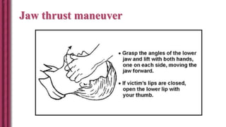 Jaw thrust maneuver
 