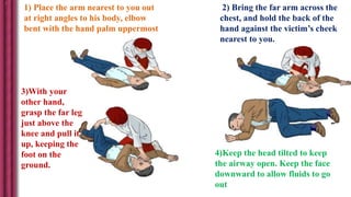 1) Place the arm nearest to you out
at right angles to his body, elbow
bent with the hand palm uppermost
2) Bring the far arm across the
chest, and hold the back of the
hand against the victim’s cheek
nearest to you.
4)Keep the head tilted to keep
the airway open. Keep the face
downward to allow fluids to go
out
3)With your
other hand,
grasp the far leg
just above the
knee and pull it
up, keeping the
foot on the
ground.
 
