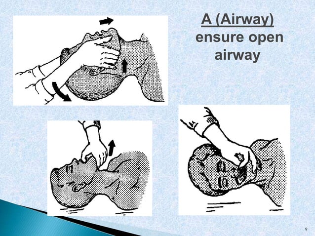 Cardiopulmonary resuscitation [cpr] | PPT