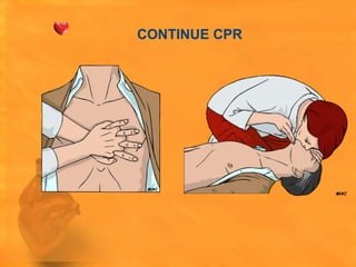 CONTINUE CPR




30                  2
 