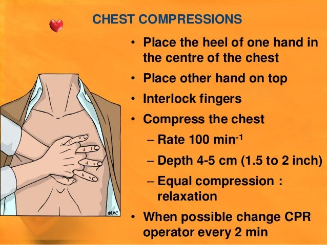 Cardiopulmonary Resuscitation Ppt
