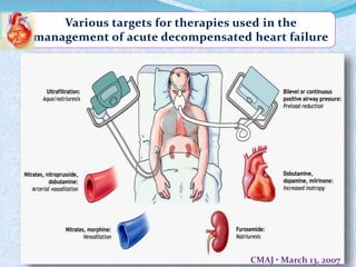 Various targets for therapies used in the 
management of acute decompensated heart failure 
CMAJ • March 13, 2007 
 