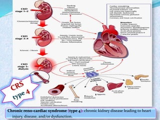 Chronic reno-cardiac syndrome (type 4): chronic kidney disease leading to heart 
injury, disease, and/or dysfunction. 
 