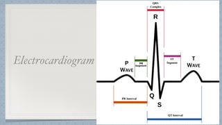 Electrocardiogram
 