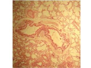 Cardiorespiratório out.2011