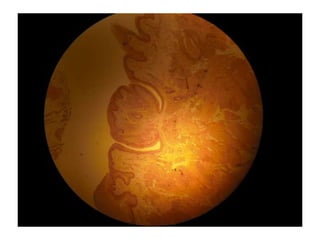 Cardiorespiratório out.2011