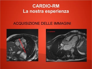 CARDIO-RM
La nostra esperienza
ACQUISIZIONE DELLE IMMAGINI
 