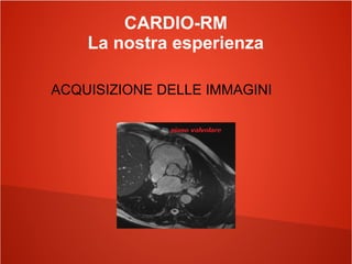 CARDIO-RM
La nostra esperienza
ACQUISIZIONE DELLE IMMAGINI
 