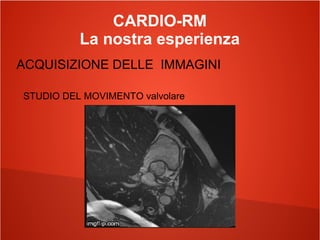 CARDIO-RM
La nostra esperienza
ACQUISIZIONE DELLE IMMAGINI
STUDIO DEL MOVIMENTO valvolare
 