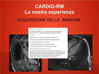 CARDIO-RM
La nostra esperienza
ACQUISIZIONE DELLE IMMAGINI
 