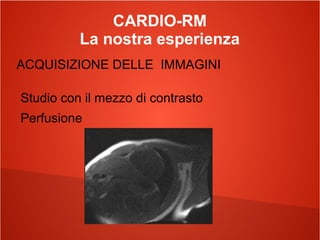 CARDIO-RM
La nostra esperienza
ACQUISIZIONE DELLE IMMAGINI
Studio con il mezzo di contrasto
Perfusione
 