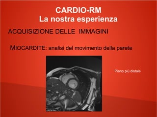 CARDIO-RM
La nostra esperienza
ACQUISIZIONE DELLE IMMAGINI
MIOCARDITE: analisi del movimento della parete
Piano più distale
 