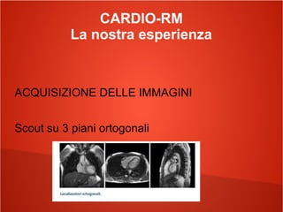 CARDIO-RM
La nostra esperienza
ACQUISIZIONE DELLE IMMAGINI
Scout su 3 piani ortogonali
 