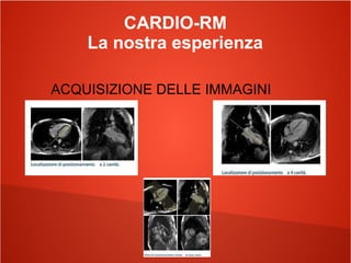 CARDIO-RM
La nostra esperienza
ACQUISIZIONE DELLE IMMAGINI
 