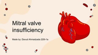 Mitral valve
insufficiency
 