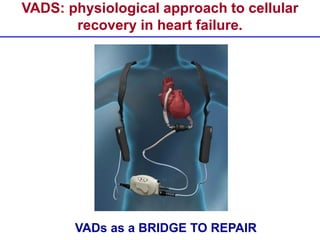 VADS: physiological approach to cellular
recovery in heart failure.
VADs as a BRIDGE TO REPAIR
 