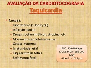 AVALIAÇÃO DA CARDIOTOCOGRAFIA
• Causas:
– Hipertermia (10bpm/oC)
– Infecção ovular
– Drogas: betamiméticos, atropina, etc
– Movimentação fetal excessiva
– Cetose materna
– Imaturidade fetal
– Taquiarritmias fetais
– Sofrimento fetal
LEVE: 160-180 bpm
MODERADA : 180-200
bpm
GRAVE: > 200 bpm
 