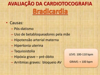 AVALIAÇÃO DA CARDIOTOCOGRAFIA
• Causas:
– Pós-datismo
– Uso de betabloqueadores pela mãe
– Hipotensão arterial materna
– Hipertonia uterina
– Taquissistolia
– Hipóxia grave – pré-óbito
– Arritmias graves: bloqueio AV
LEVE: 100-110 bpm
GRAVE: < 100 bpm
 